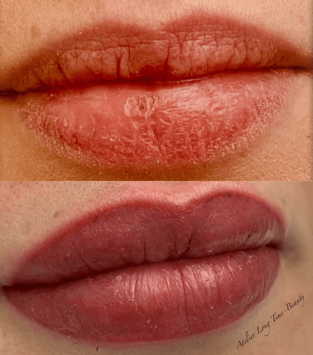 Lippen vorher mit älterem Permanent Make-up und nachher mit neuer Kontur und warmem Beerenton