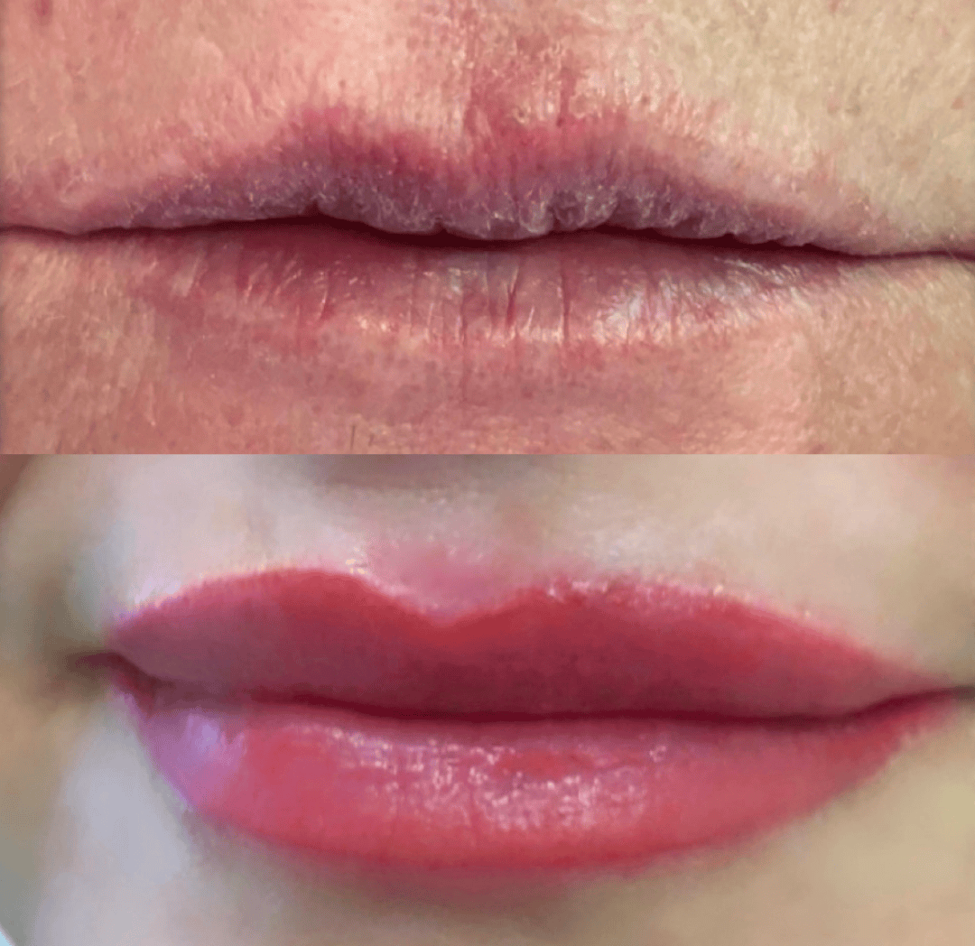 Lippen vorher blass und ohne Kontur und nachher mit zartem, frischem Farbaufbau