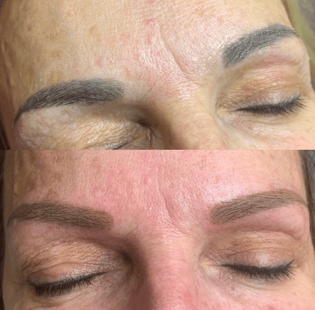 Augenbrauen vorher mit altem Permanent Make-up und nachher nach Aufhellung und Korrektur